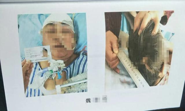 震惊心灵之痛，女子目睹母亲被撞飞，受惊吓身亡的悲剧故事