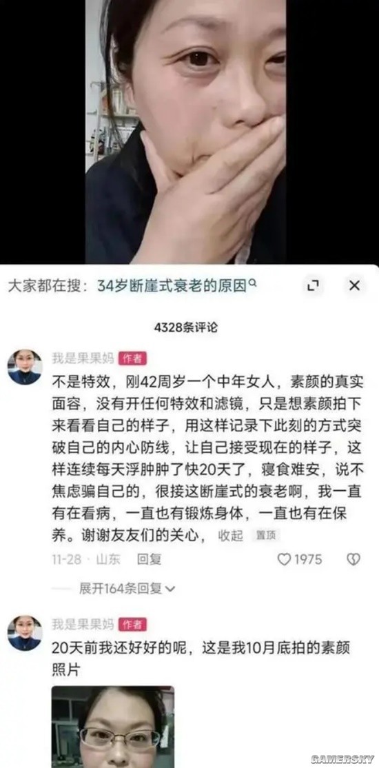 女生确诊渐冻症一年容貌巨变，挑战与希望并存