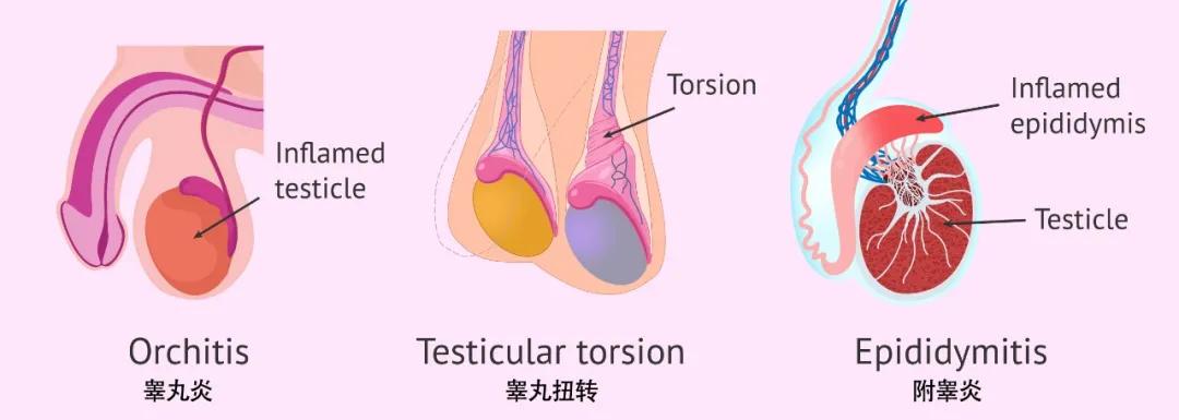 10岁男孩遭遇校园悲剧，睾丸被同学重创，事件背后隐藏哪些真相？